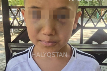 Фотография к новости: Жительница Шымкента заявила, что ее сына избили в лагере