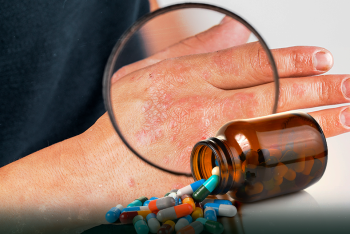 Фотография к новости: Казахстанские врачи заявили о новом тяжелом постковидном синдроме