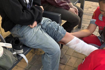 Фотография к новости: В Алматы девочка получила перелом ноги после наезда самокатчиков