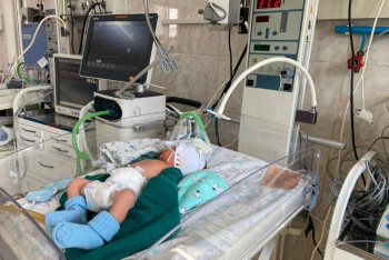 Фотография к новости: В Алматы спасли крошечного недоношенного ребёнка весом 700 грамм